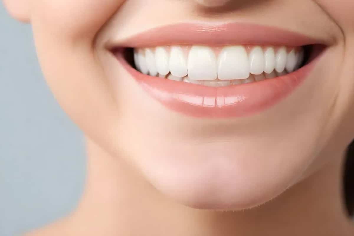 Straighten Your Smile in Purley